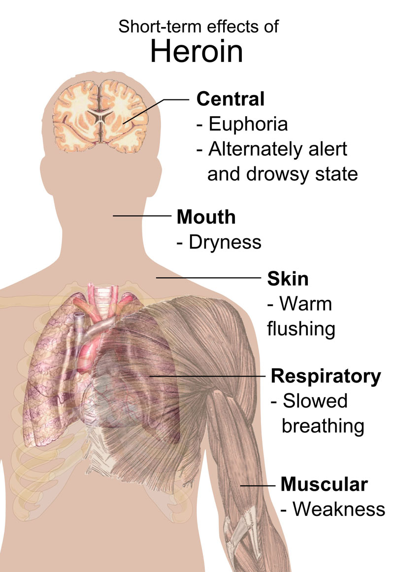 Short-term effects of Heroin