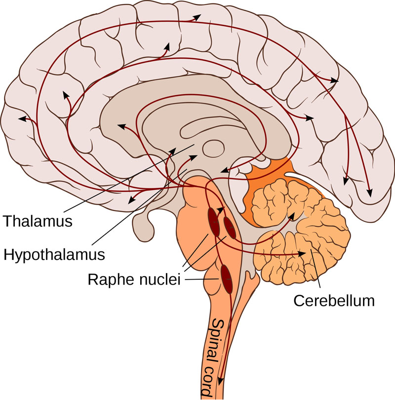 Somatic markers are probably stored in the ventromedial prefrontal cortex; pictured.