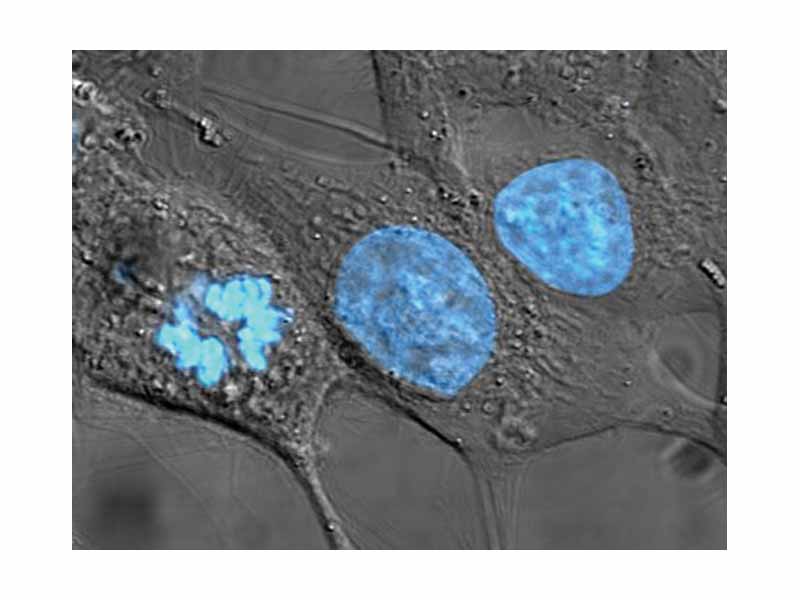 HeLa cells stained for DNA with the Blue Hoechst dye. The central and rightmost cell are in interphase, thus their entire nuclei are labeled. The left cell is in the process of nuclear division (mitosis) where separated chromosomes can be identified.