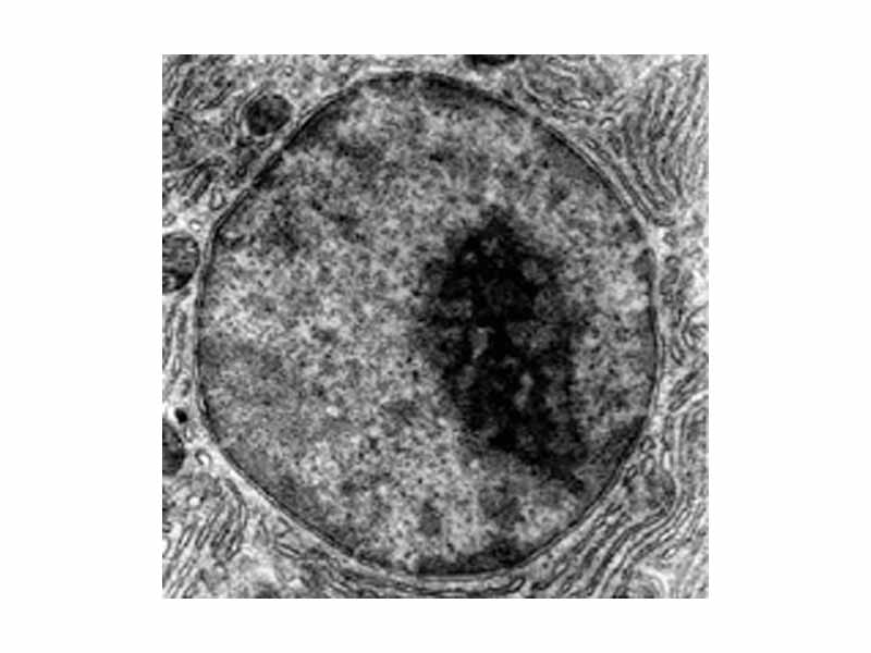 Micrograph of a cell nucleus published in Inside the Cell, a publication of the US National Institute of General Medical Sciences/National Institutes of Health.