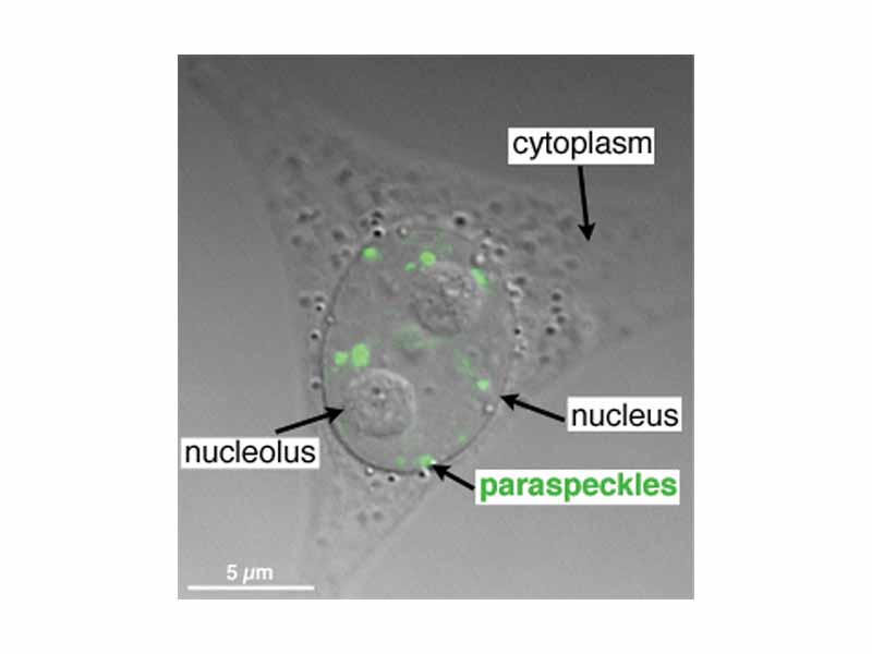 An overlay of a fluorescence micrograph (green) onto a DIC image of a HeLa cell expressing a Yellow fluorescent Protein fusion of Paraspeckle Protein 1 (PSP1)