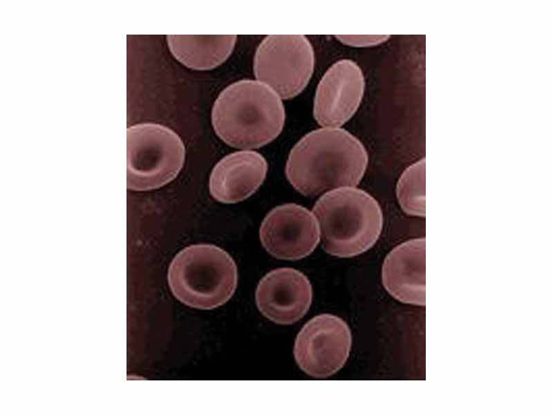 Human red blood cells, like those of other mammals, lack nuclei. This occurs as a normal part of the cells' development.