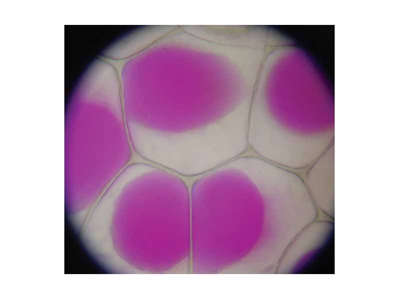 The vacuole of Rhoeo discolor - shrunk during plasmolysis