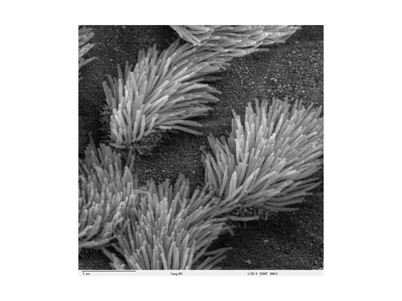 SEM micrograph of the cilia projecting from respiratory epithelium in the lungs