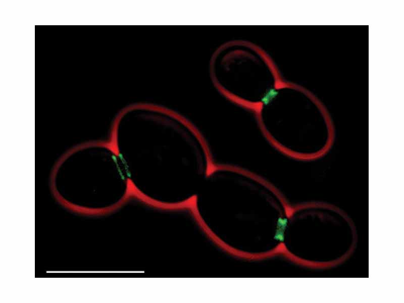 Septins in Saccharomyces cerevisiae (fluorescent micrograph) - Green: septins (AgSEP7-GFP) - Red: cell outline (phase contrast) - Scale bar: 10 ?m