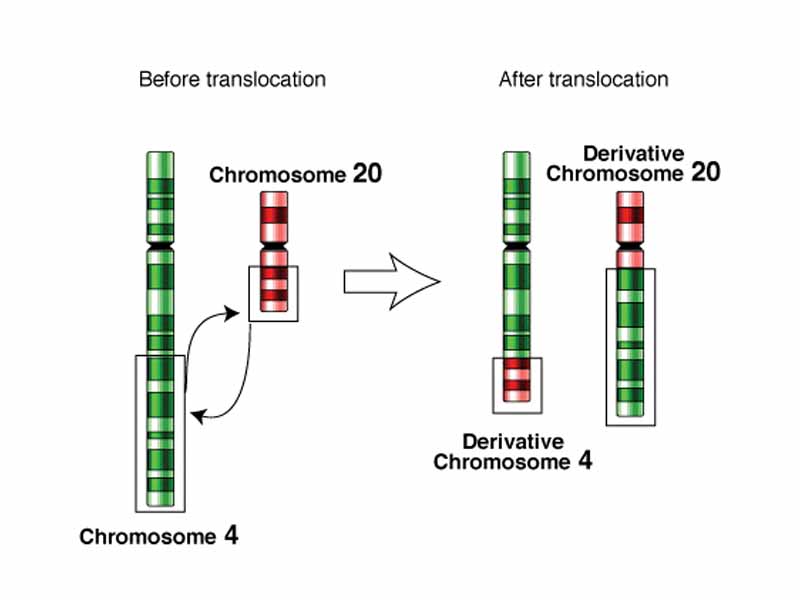 Chromosomal translocation of the 4th and 20th chromosome.