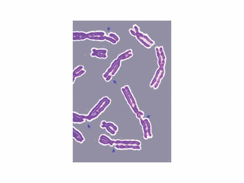 DNA damage resulting in multiple broken chromosomes