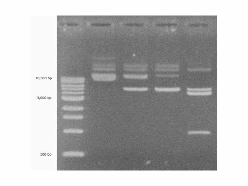 DNA agarose gel. The first lane contains a DNA ladder for sizing, and the other four lanes show variously-sized DNA fragment that are present in some but not all of the samples.
