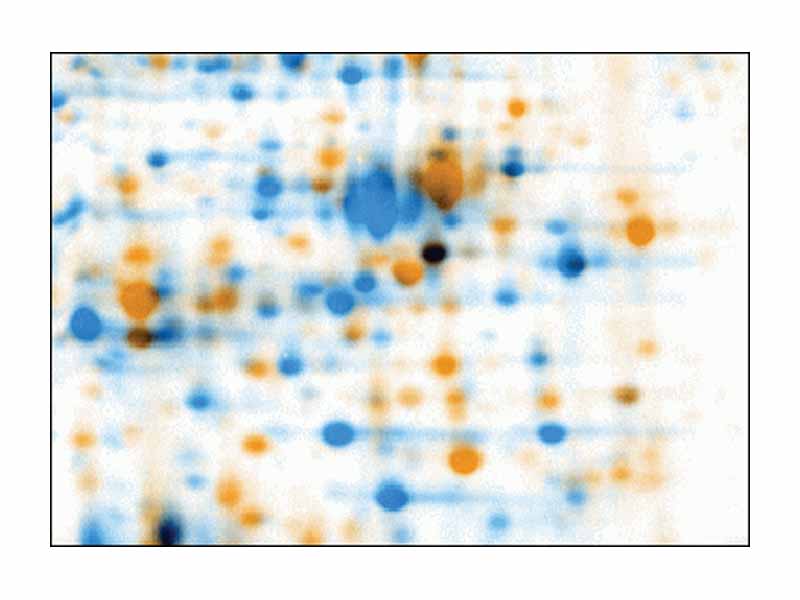 Warping: Images of two 2D electrophoresis gels, overlaid with Delta2D, another leading 2-DE image analysis software package. First image is colored in orange, second one colored in blue. Due to running differences, corresponding spots do not overlap.