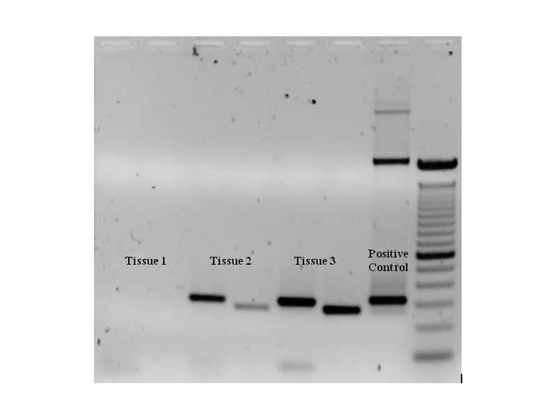 Ethidium bromide-stained PCR products after Gel electrophoresis. Two sets of primers were used to amplify the IGF gene from three different DNA samples. In sample #1 the gene was not amplified by PCR, whereas bands for tissue #2 and #3 indicate successful amplification of the IGF gene. A positive control, and a DNA ladder containing DNA fragments of defined length (last lane to the right) to estimate fragment sizes in the experimental PCRs, were also ran on this gel