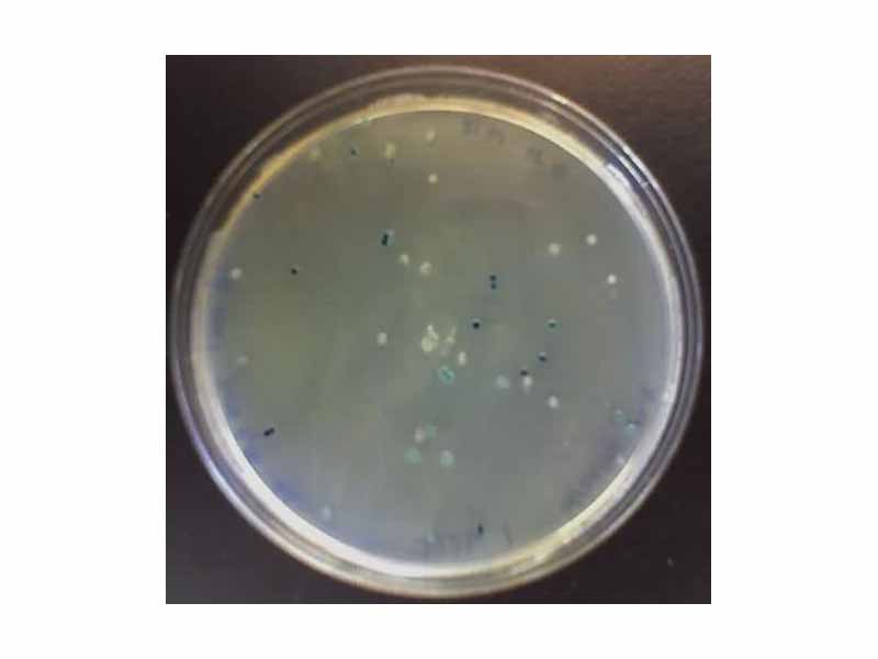A LB agar plate showing the result of a blue white screen.