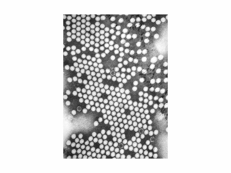 TEM micrograph of Polio virus