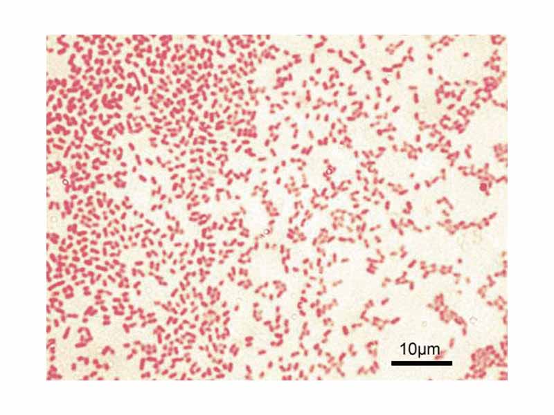 Gram-negative Pseudomonas aeruginosa bacteria (pink-red rods).