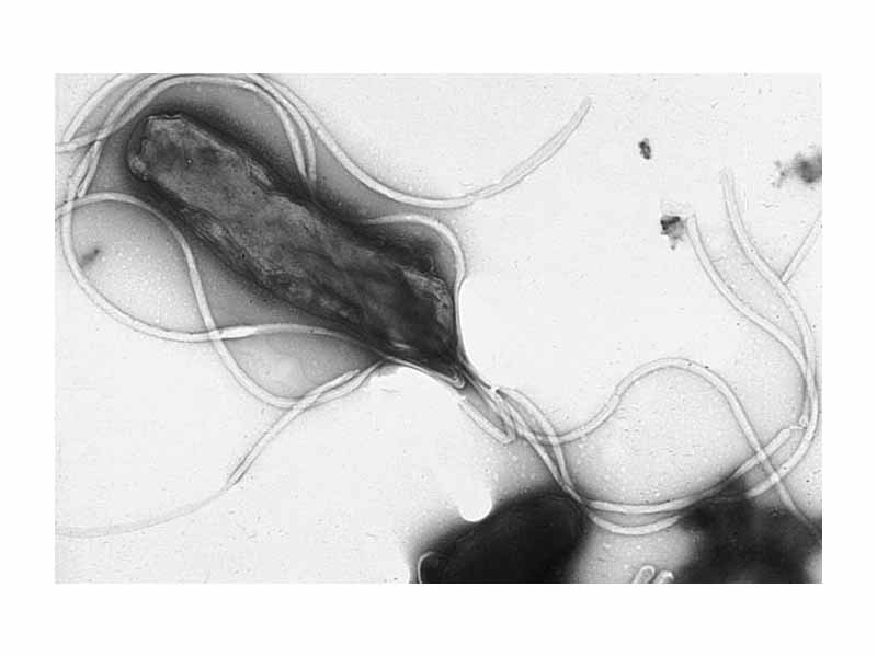 Electron micrograph of H. pylori possessing multiple flagella (negative staining). 