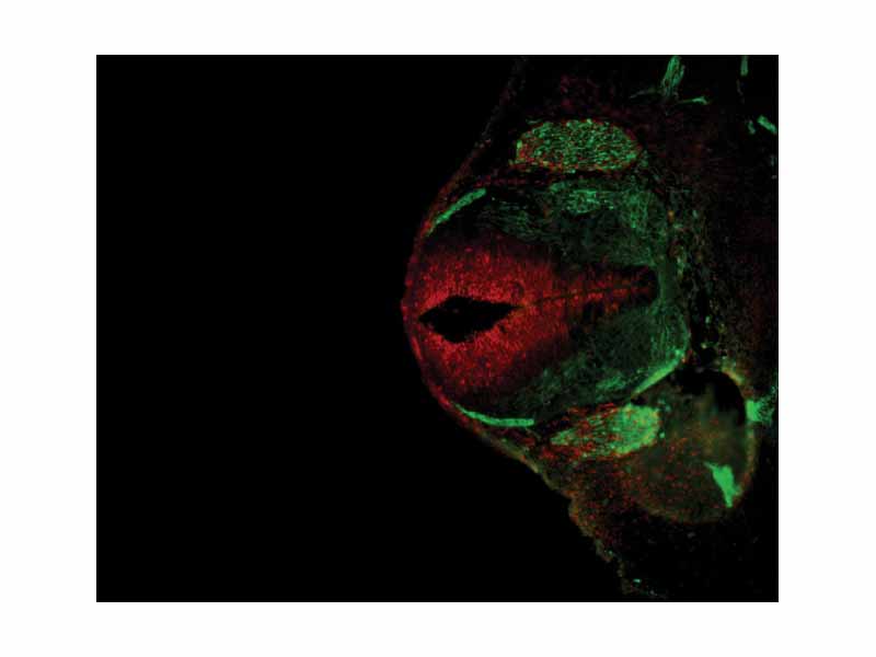 Antibody stain against Neurofilament (green) and Ki 67 (red) in a Mouse embryo 12.5 days after fertilization. The cells expressing neurofilaments are in the dorsal root ganglions shown in green while proliferating cells are in the ventricular zone in the neural tube and colored red.