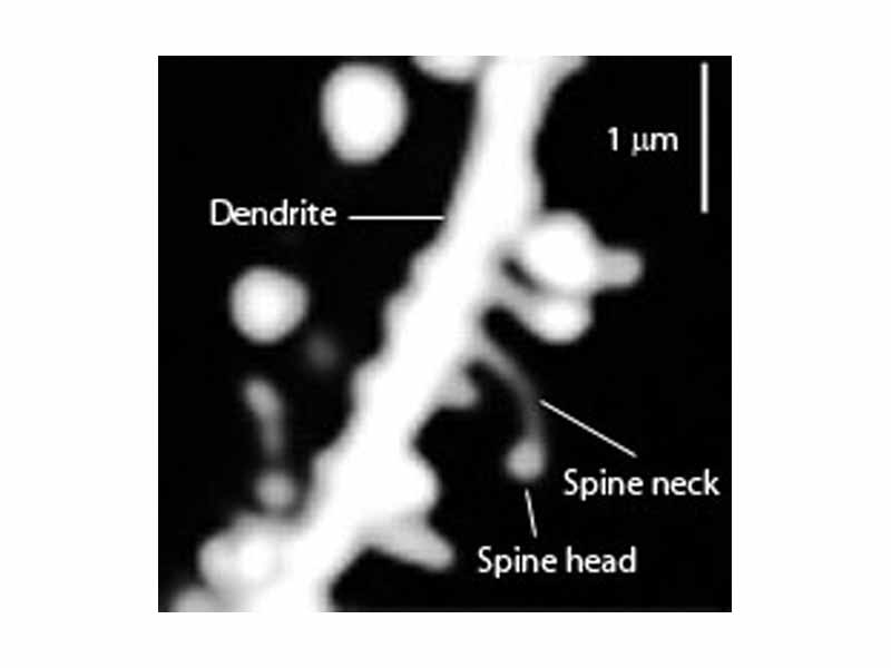 Close up of the dendrite of a striatal medium spiny neuron.