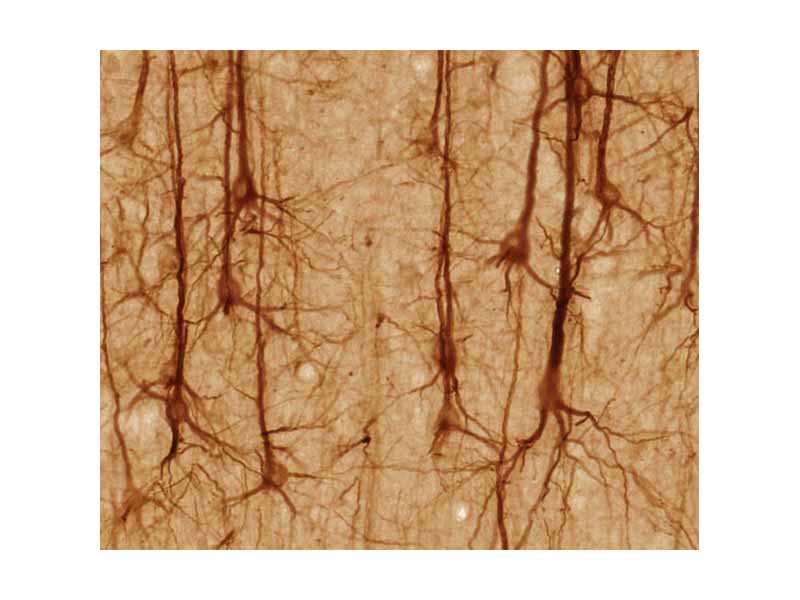 SMI32-stained pyramidal neurons in cerebral cortex.
