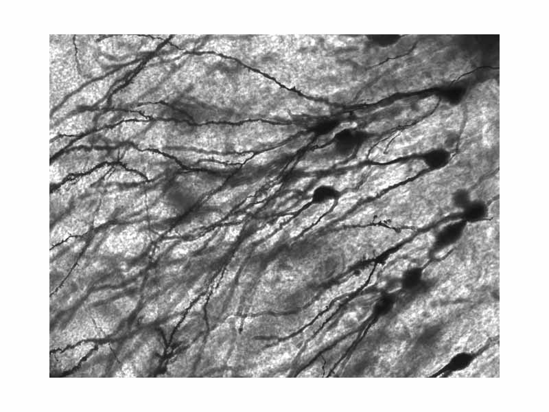 Golgi-stained neurons in human hippocampal tissue.