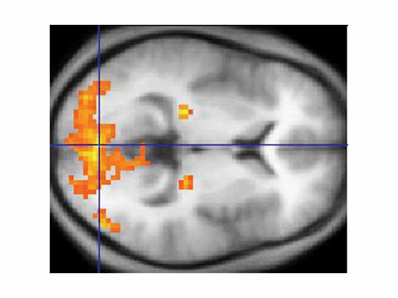 A scan of the brain using fMRI