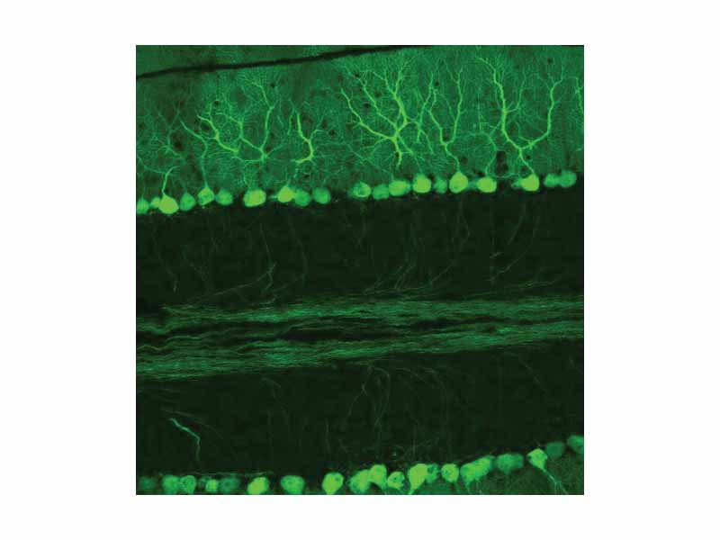 Confocal micrograph from mouse cerebellum expressing green-fluorescent protein in Purkinje cells.