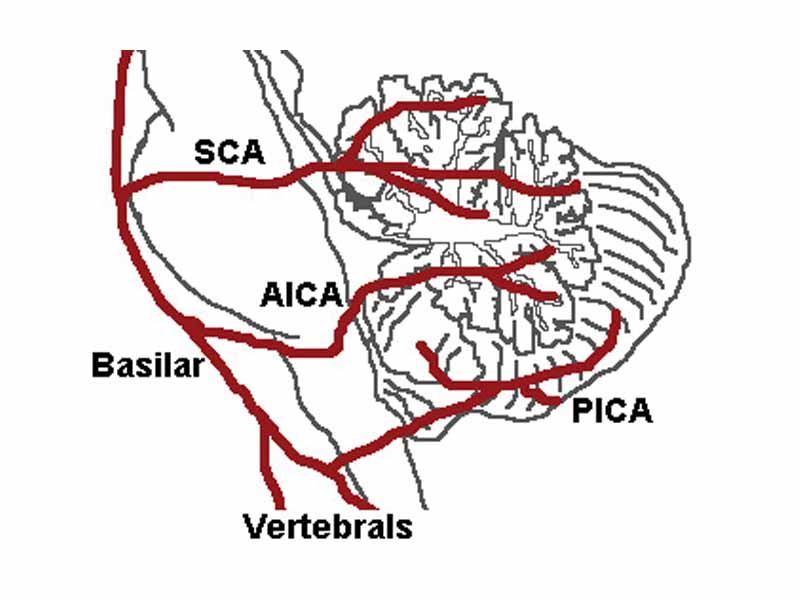 The three major arteries of the cerebellum: the SCA, AICA, and PICA.