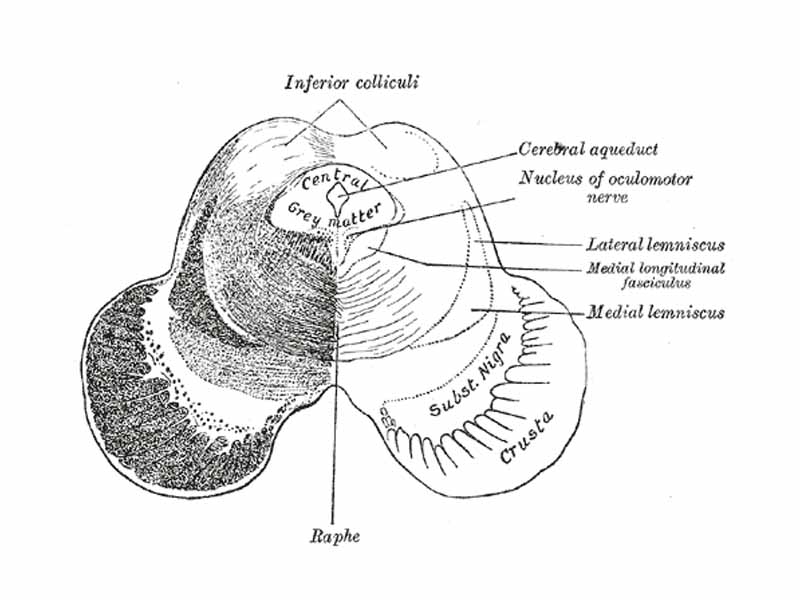 Transverse section of mid-brain at level of inferior colliculi.