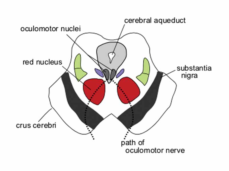 Section through superior colliculus (unlabeled) showing path of oculomotor nerve