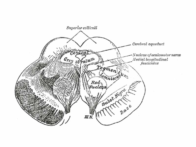 Transverse section of mid-brain at level of superior colliculi.
