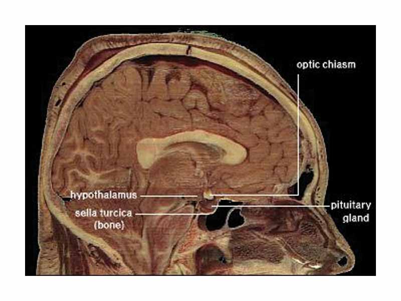 Location of the human hypothalamus