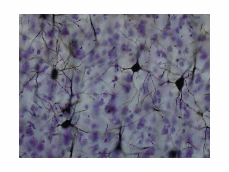 Golgi-stained neurons in the somatosensory cortex of the macaque monkey.