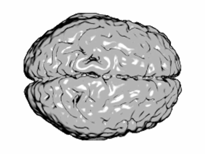 The human brain as viewed from above, showing the cerebral hemispheres. The anterior aspect (front) of the brain is to the right.