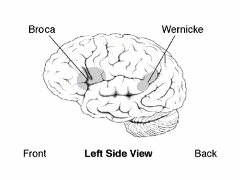 Approximate location of Broca's area highlighted in gray
