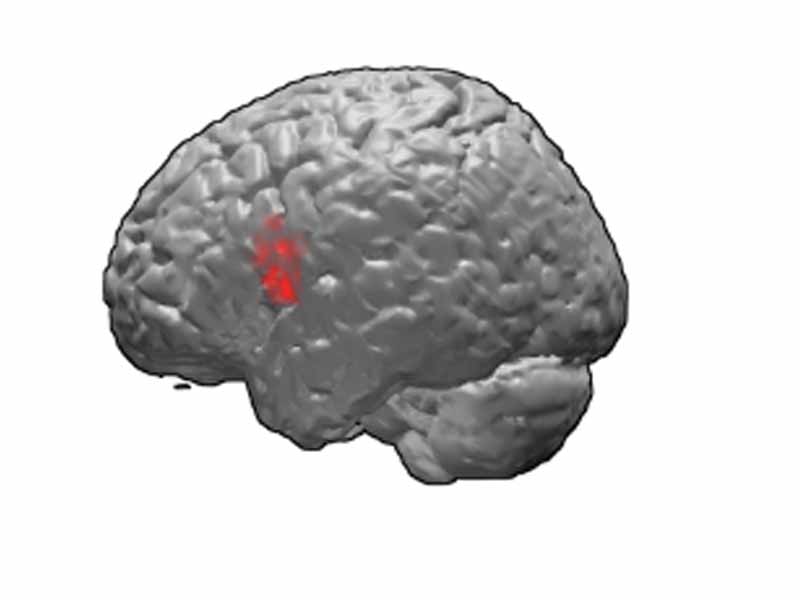 Brodmann area 44.  BA44 is in the frontal lobe.