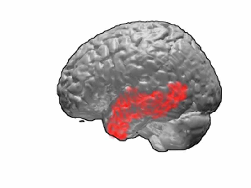 Brodmann area 21.  BA 21 lies on the lateral surface (side) of the temporal lobe.