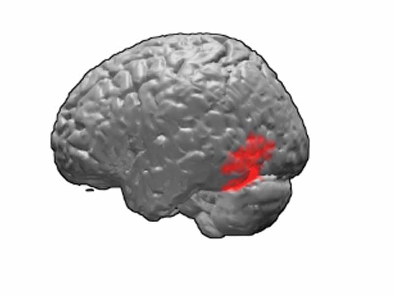 Brodmann area 37, or BA37, is part of the temporal cortex in the human brain.