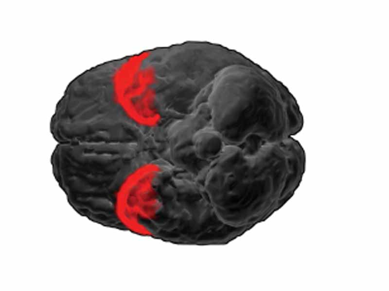 Brodmann area 38, or BA38, is part of the temporal cortex in the human brain.