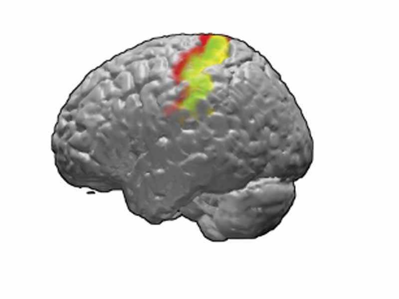 Brodmann areas 3, 1 and 2 of human brain. Brodmann area 3 is in red, area 1 in green, and area 2 in yellow.