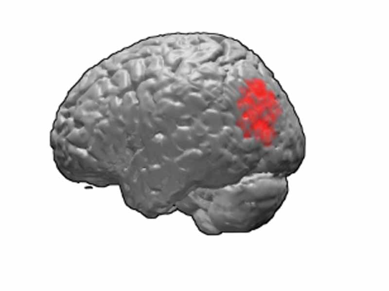 Brodmann area 39, or BA39, is part of the parietalcortex in the human brain.
