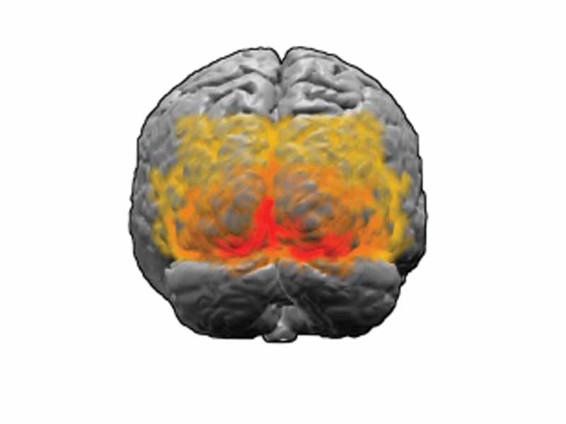 Brodmann area 17 (primary visual cortex) is shown in red in this image which also shows area 18 (orange) and 19 (yellow)