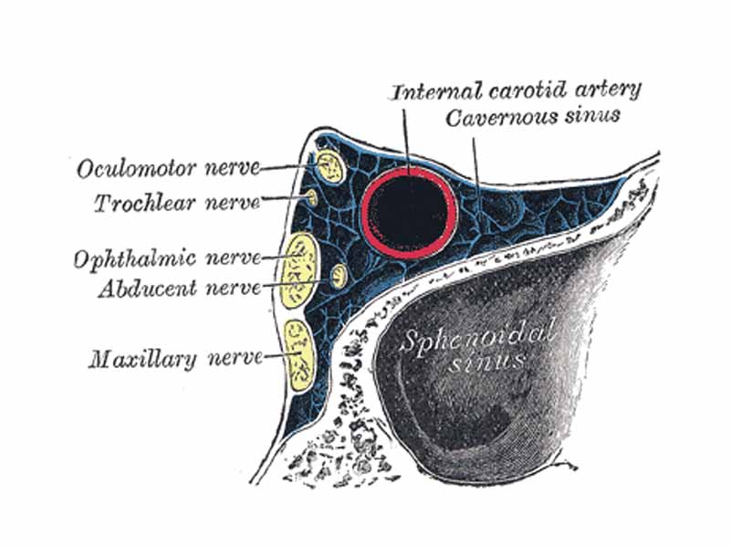 Oblique section through the right cavernous sinus.