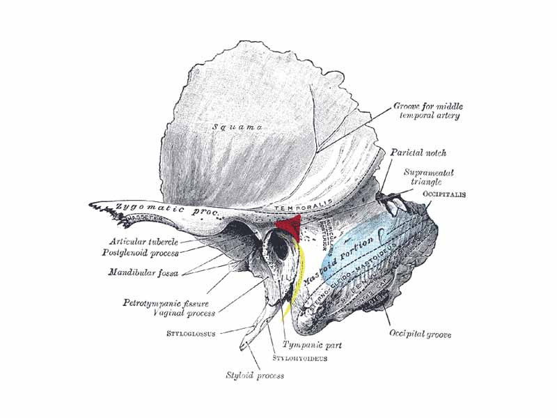 Left temporal bone showing surface markings for the tympanic antrum (red), transverse sinus (blue), and facial nerve (yellow).