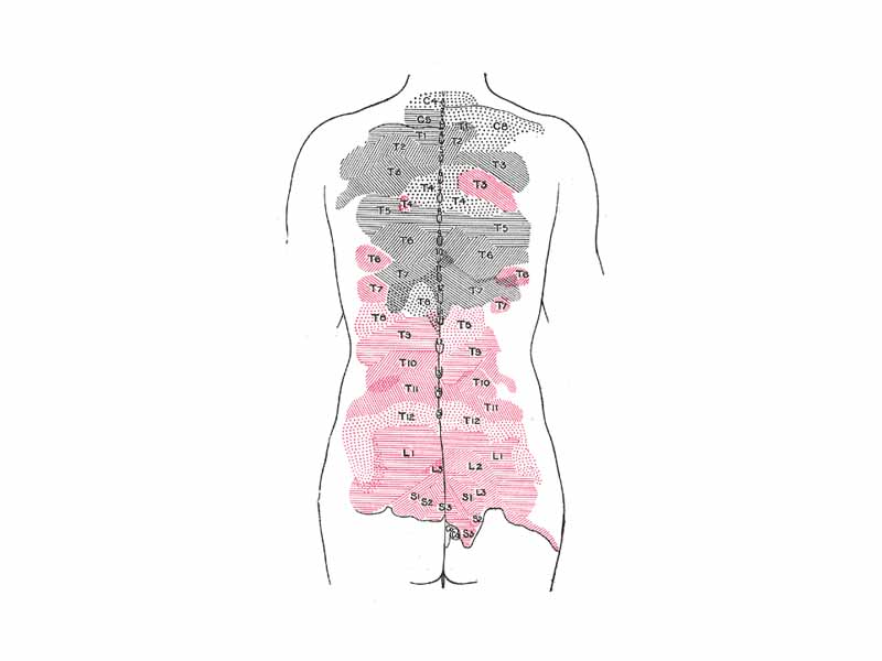 Areas of distribution of the cutaneous branches of the posterior divisions of the spinal nerves.