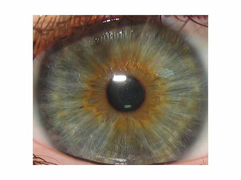 The iris is the green/grey/brown area. The other structures visible are the pupil in the centre and the white sclera surrounding the iris. The overlying cornea is pictured, but not visible, as it is transparent.