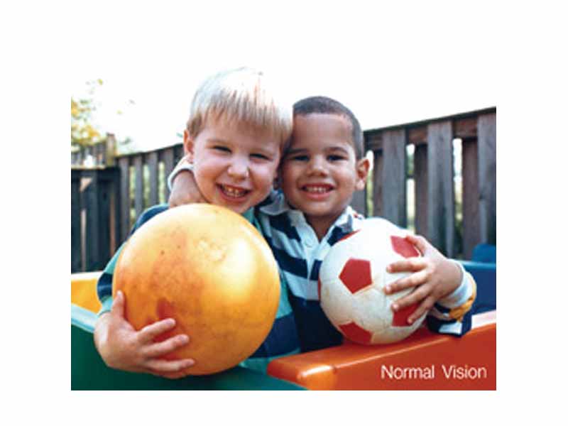 Normal vision. Courtesy NIH National Eye Institute