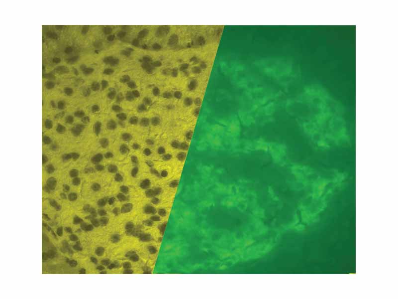 A porcine islet of Langerhans. The left image is a brightfield image created using hematoxylin stain; nuclei are dark circles and the acinar pancreatic tissue is darker than the islet tissue. The right image is the same section stained by immunofluorescence against insulin, indicating beta cells