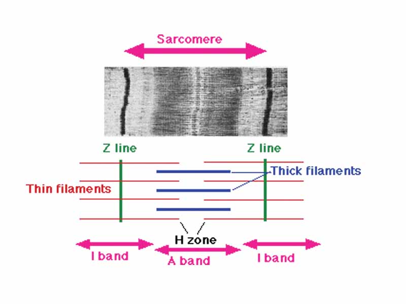 Image of sarcomere