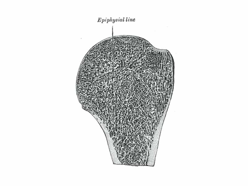 Longitudinal section of head of left humerus.