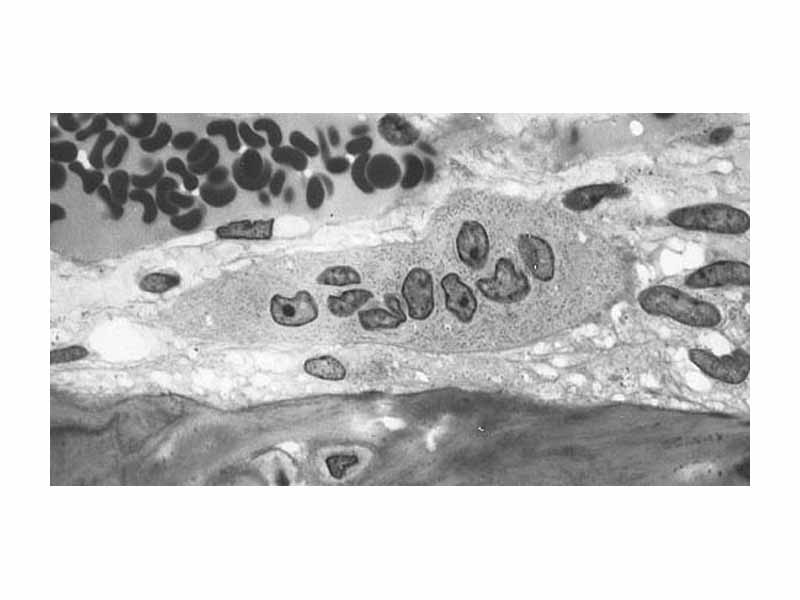Osteoclast displaying many nuclei within its foamy cytoplasm