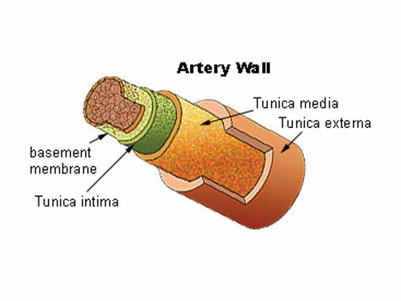 Schematic view of an artery