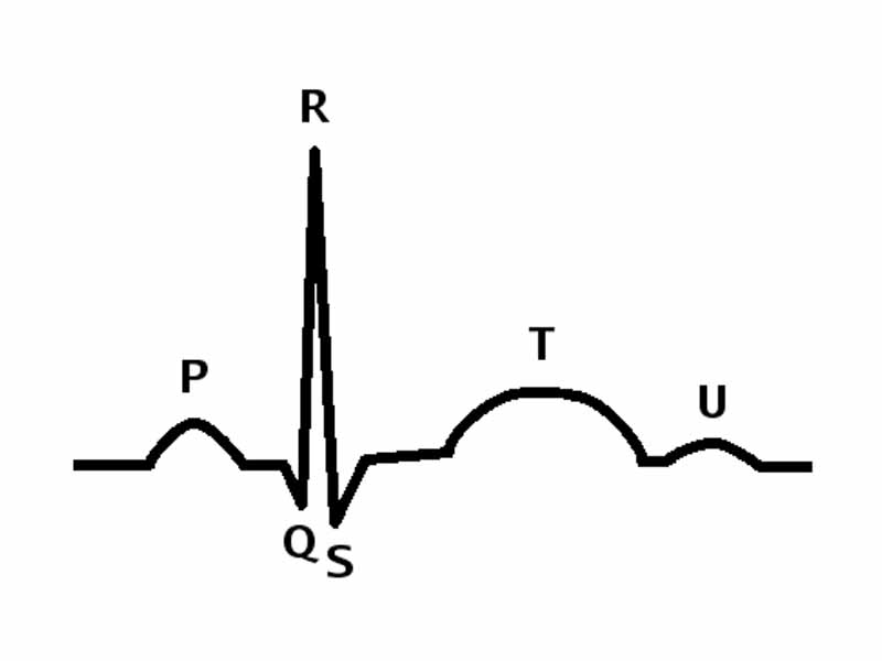 The parts of a QRS complex. Ventricular systole begins at the QRS.